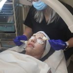 minifacial